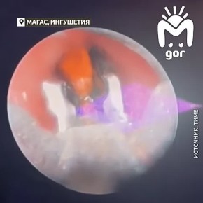 Трёхлетний малыш из Ингушетии подавился семечками